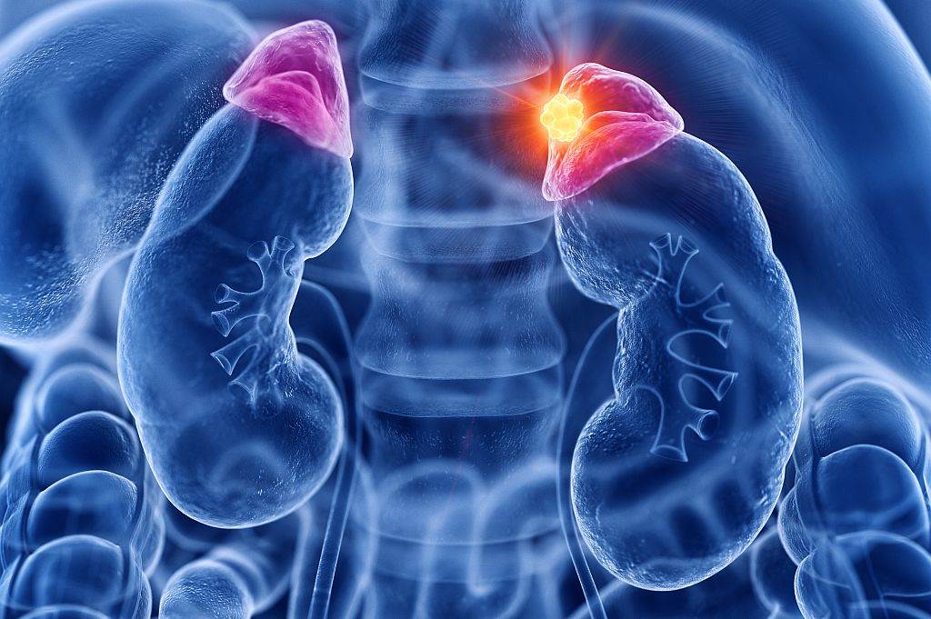 TUMOR NADBUBREŽNE ŽLEZDE: simptomi, laparoskopska operacija i oporavak ...