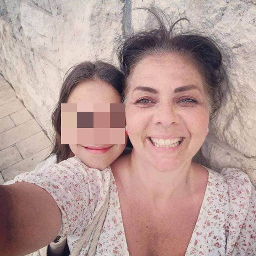 Fotografija Kristine Kovač bez šminke