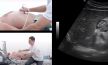 pregled pankreasa ultrazvuk