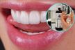 zubi vodica za ispiranje usta