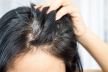 4 zdravstvena problema o kojima može da govori rana pojava sede kose