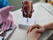 Svi detalji o operaciji hemoroida