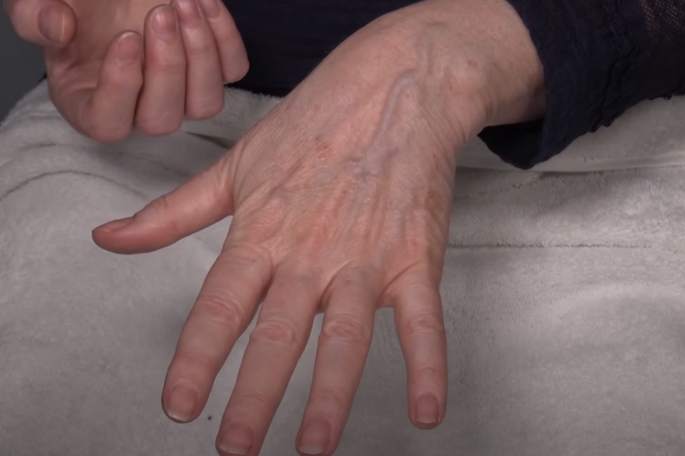 simptomi srcanih bolesti