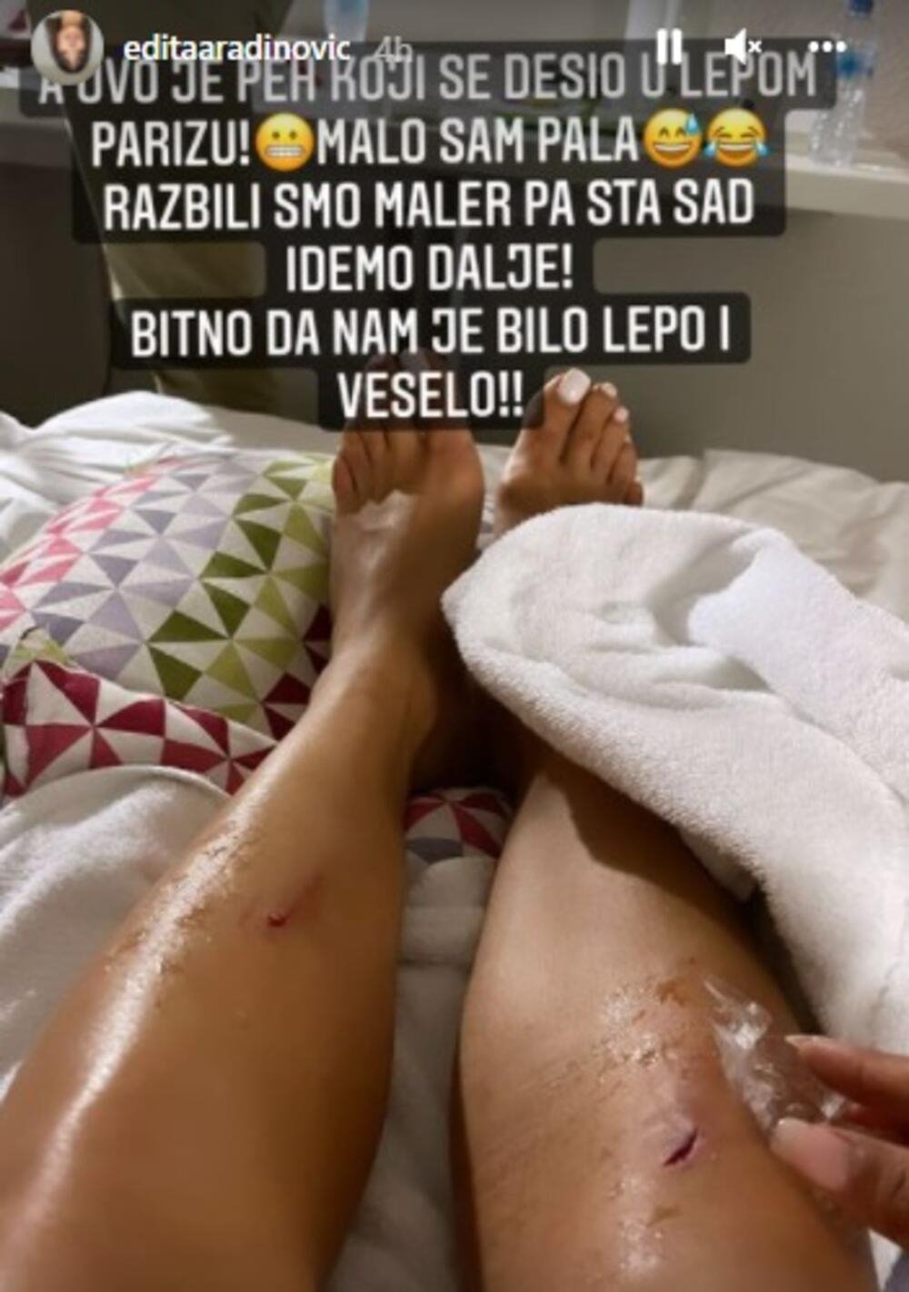 Edita Aradinović povreda