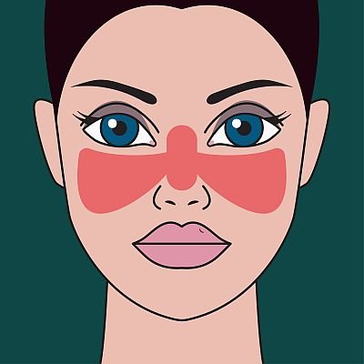 Crvenilo u obliku leptira može biti simptom lupusa.