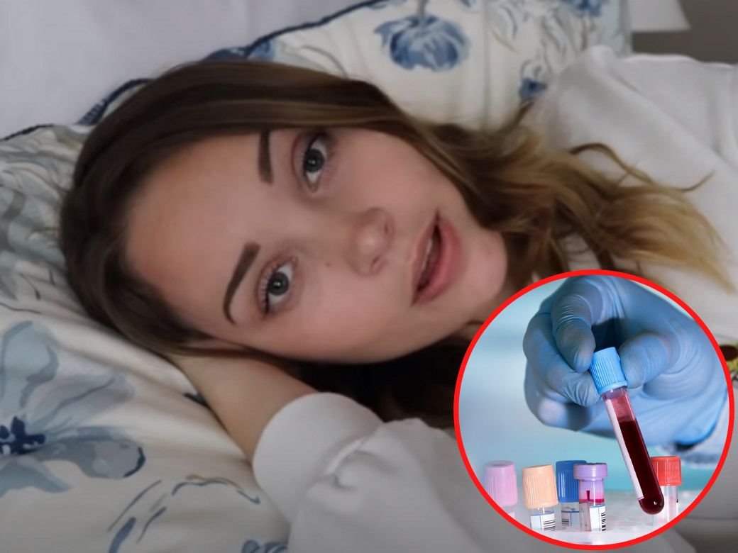 umor je simptom niskog gvozdja u krvi