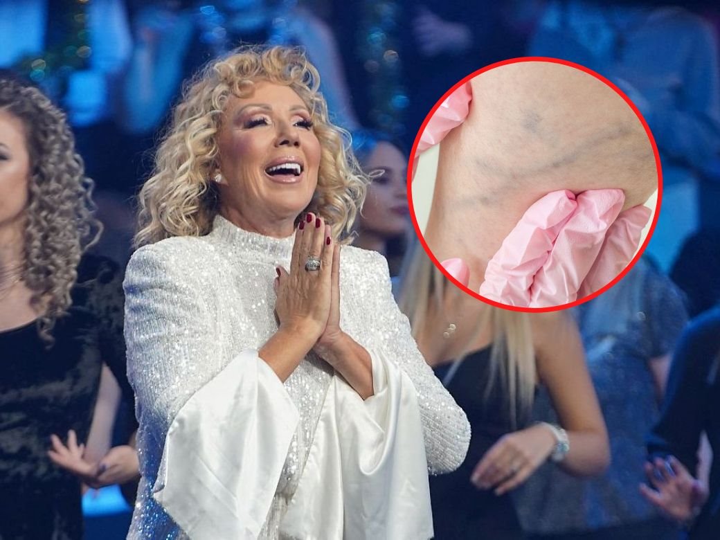 kako je lepoj breni otkrivena tromboza