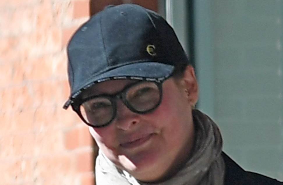 Lindu Eveđelistu kozmetički zahvat trajno defomisao