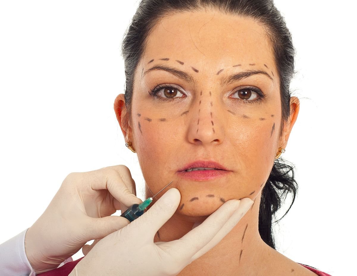 krema umesto botoksa