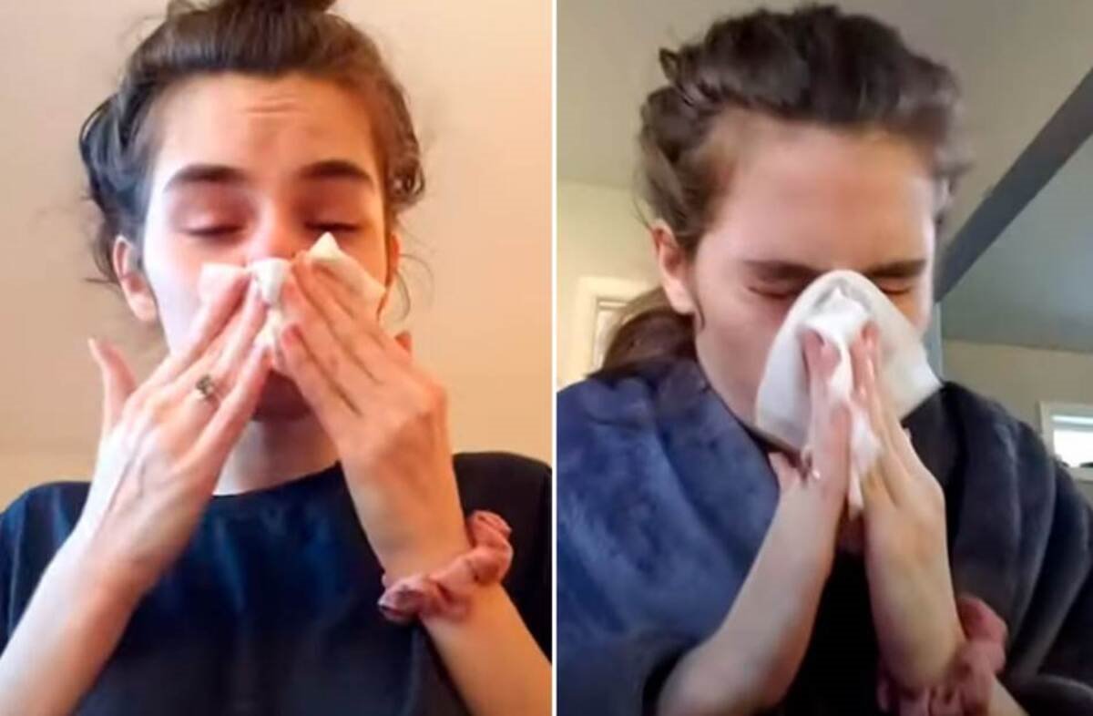 Hrana kao uzrok zapušenog nosa