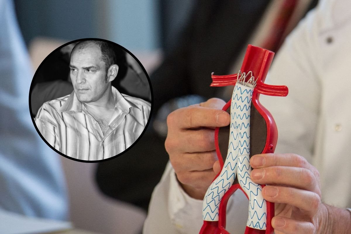 igor starovic aneurizma