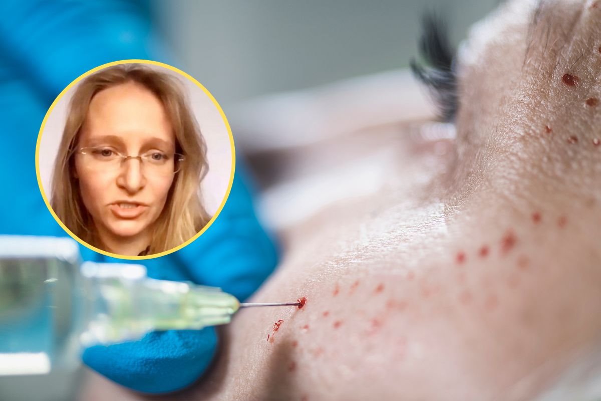 putinova cerka prp tretman