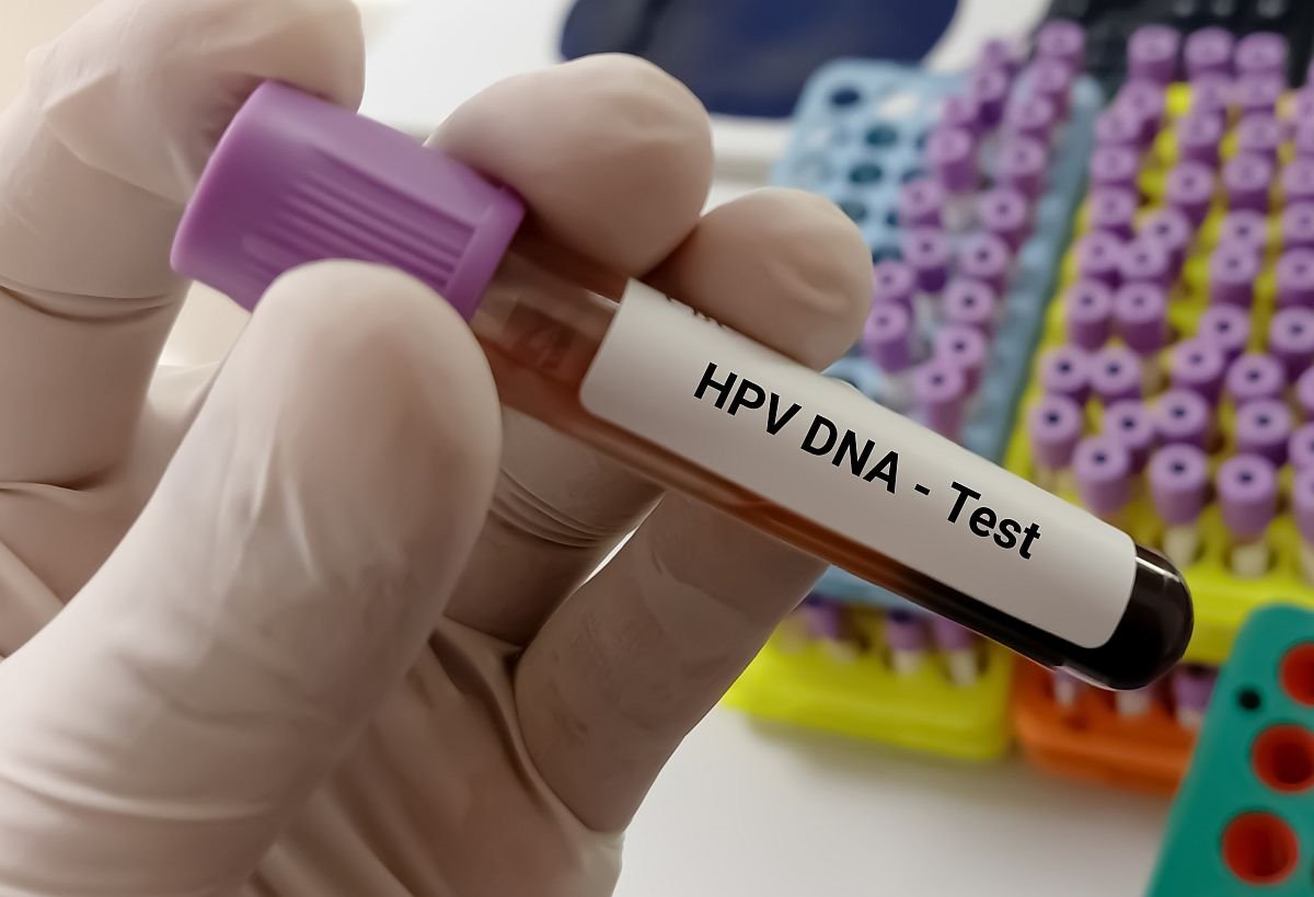 hpv humani papiloma virus