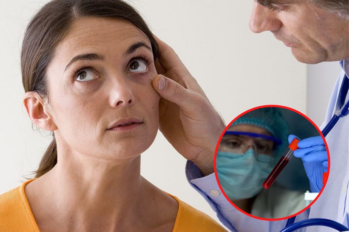 anemija malokrvnost.jpg