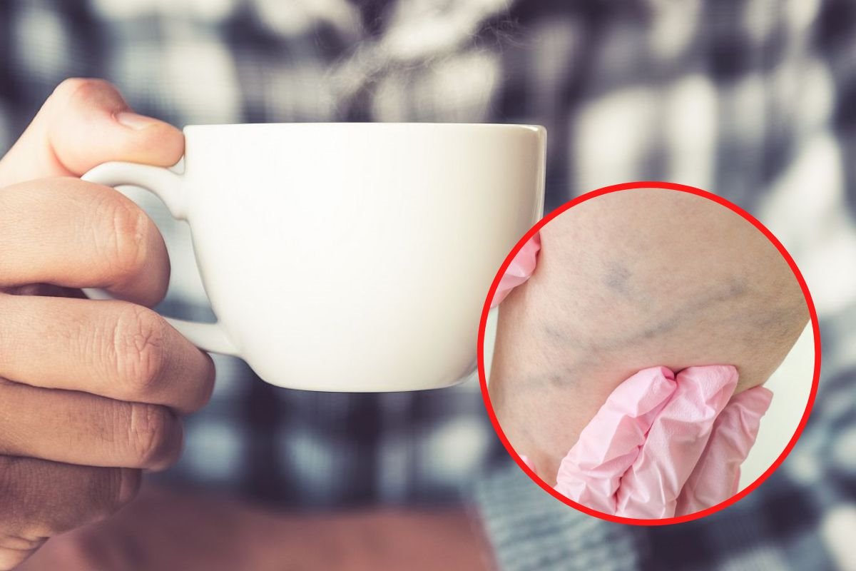 da li kafa izaziva trombozu.jpg