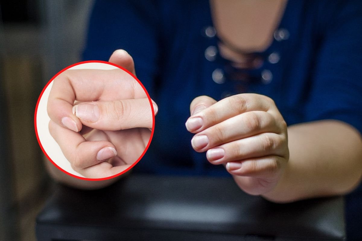 nokti koji se ljuste i pucaju.jpg