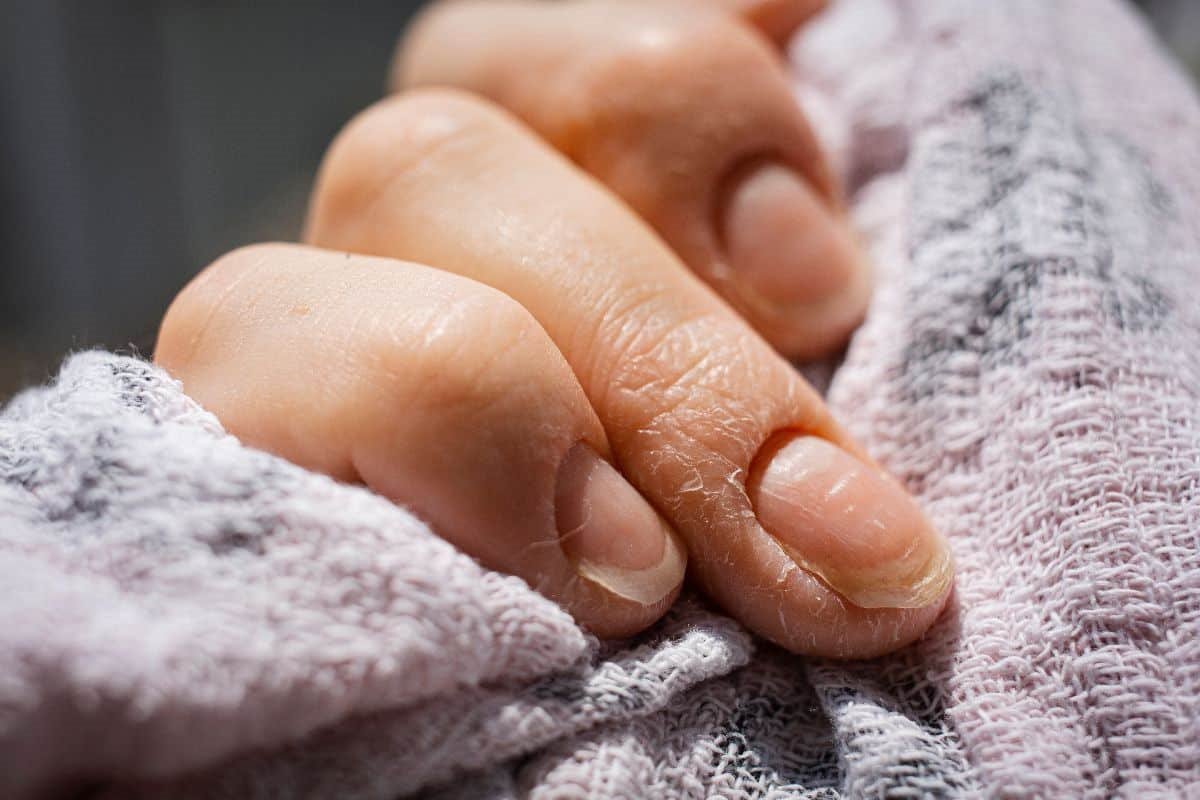 brazde na noktima-min.jpg