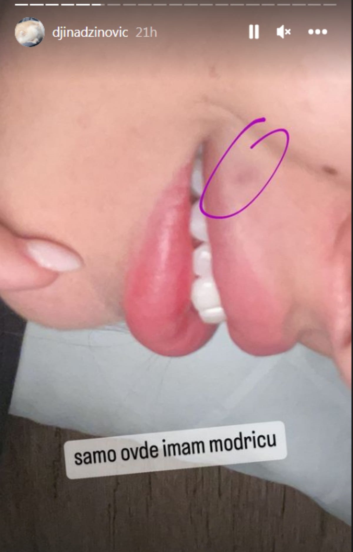 djina dzinovic usne 3-min.jpg