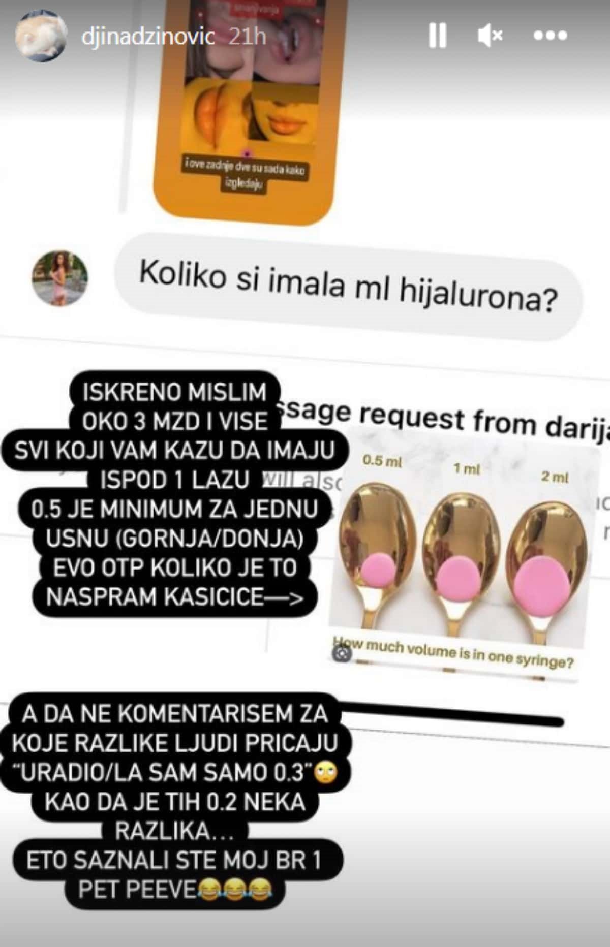 djina dzinovic usne 4-min.jpg