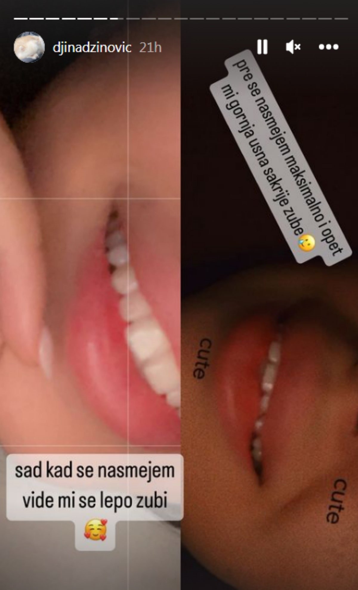 djina dzinovic usne 6-min.jpg