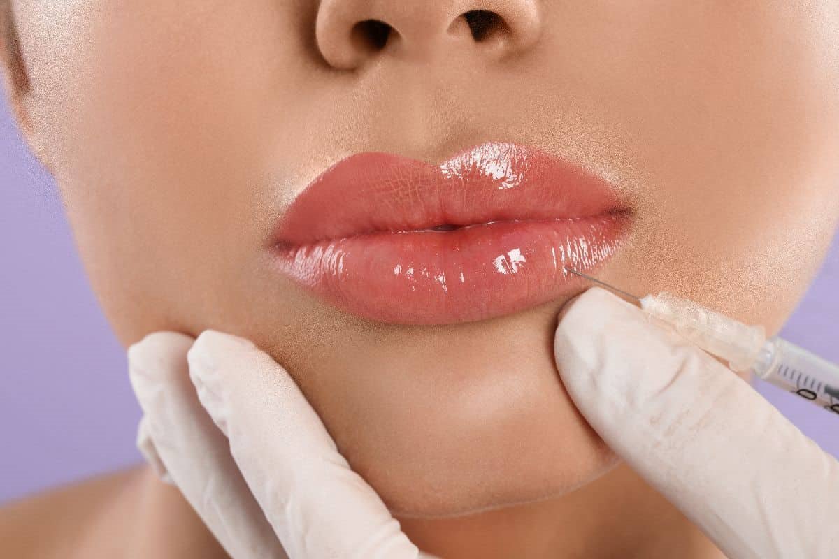 fileri za usne 4-min.jpg