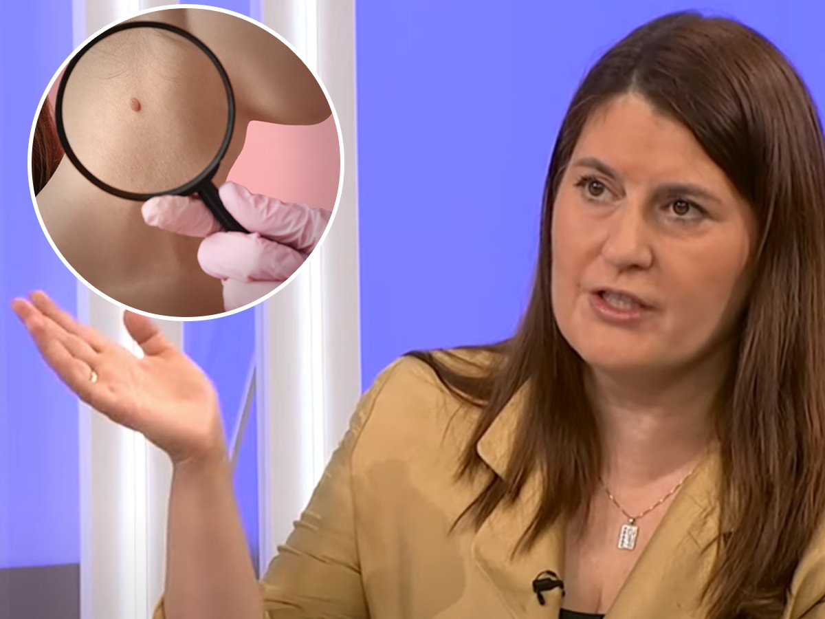 Lidija Kandolf o simptomima melanoma