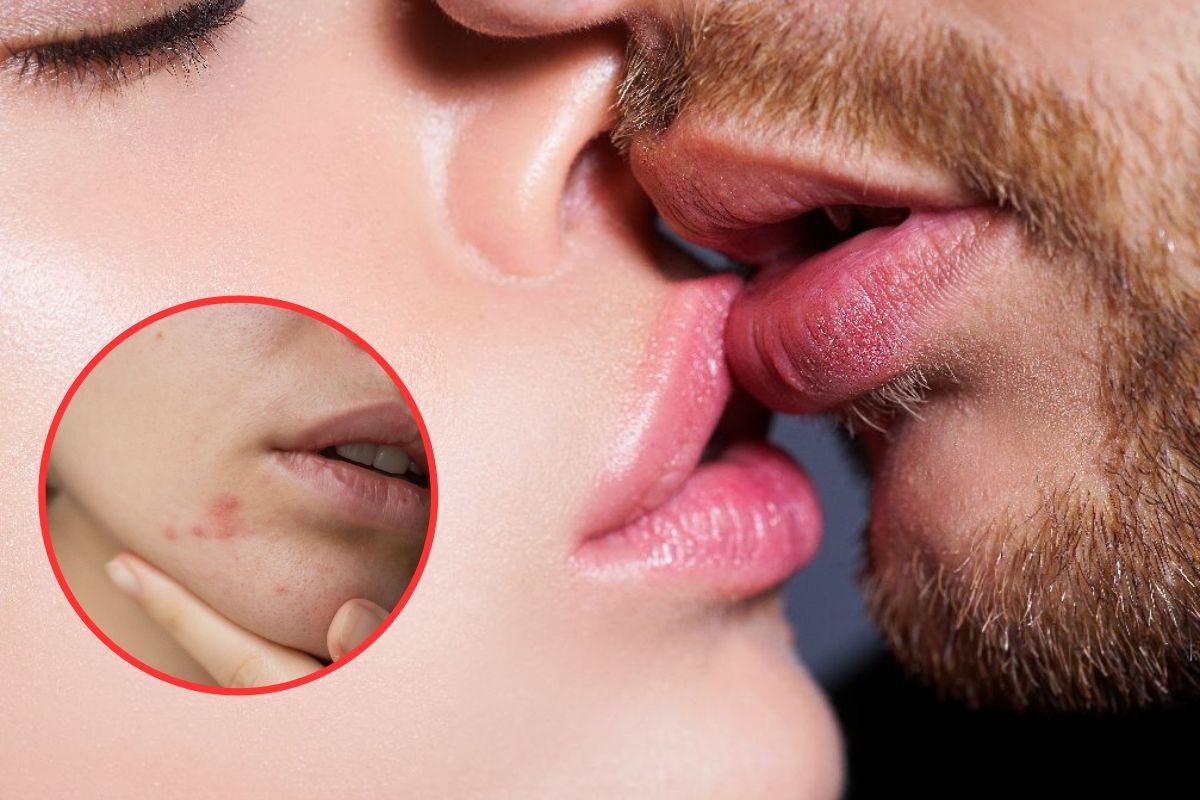 zena se ljubi muskarac ima bradu.jpg