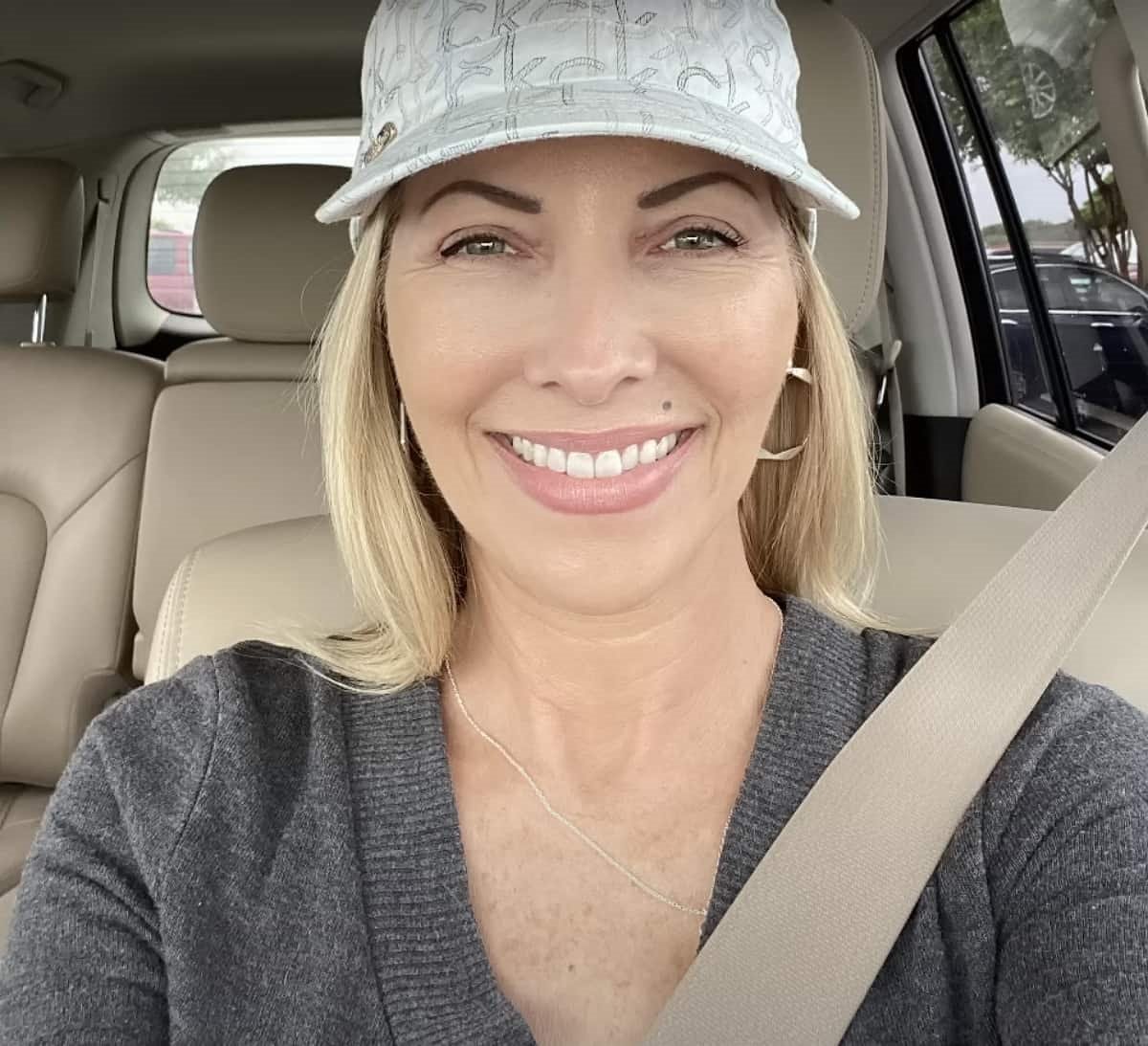 blefaroplastika operacija kapaka 8 dan-min.jpg