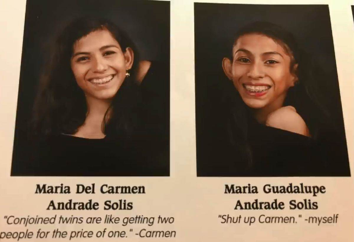 Spojene bliznakinje šokirale javnost samo jedna ima muža