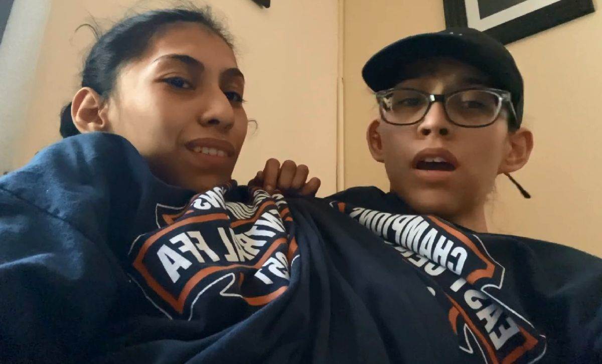 Spojene bliznakinje šokirale javnost samo jedna ima muža