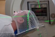 muskarac pacijent glava zracenje rak mozga.jpg