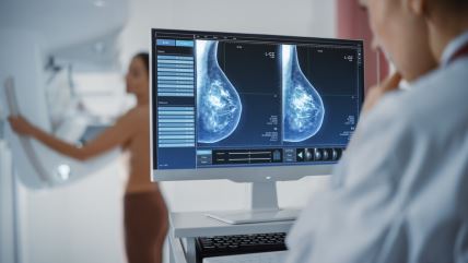 mamografija (1).jpg