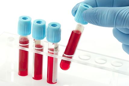 laboratorijska analiza krvi 2.jpg
