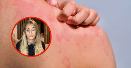mlada majka alergicna na vodu.jpg