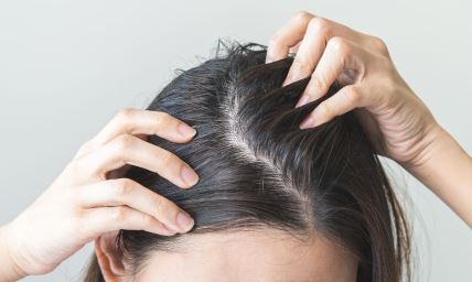 da li vam opada kosa.jpg