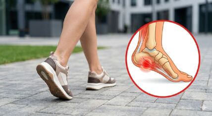 bol u stopalu plantarni fascitis.jpg