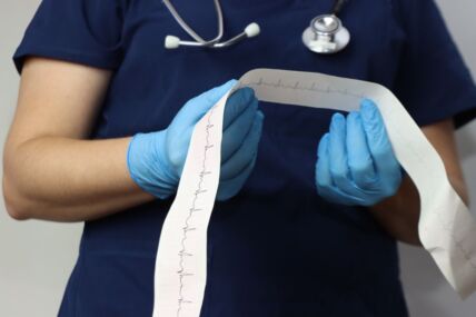 ekg_2464946747.jpg