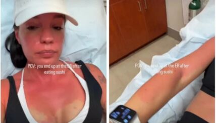 zena alergicna na susi.jpg