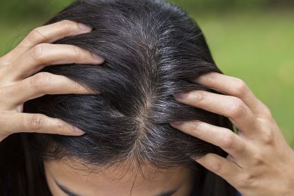 4 zdravstvena problema o kojima može da govori rana pojava sede kose