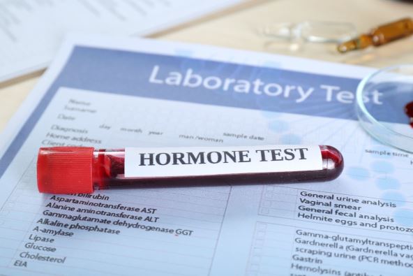 test hormona.jpg