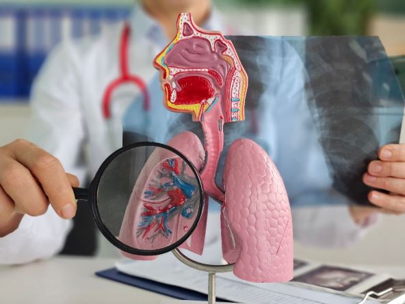 hronicna bolest pluca 3.jpg