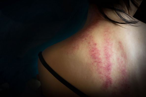 seksualno ropstvo 03.jpg