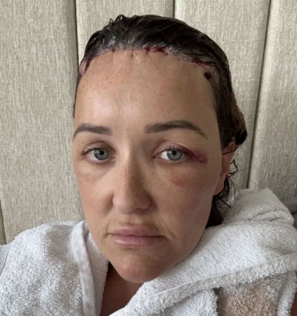 operacija cela 3 florencechloe.jpg