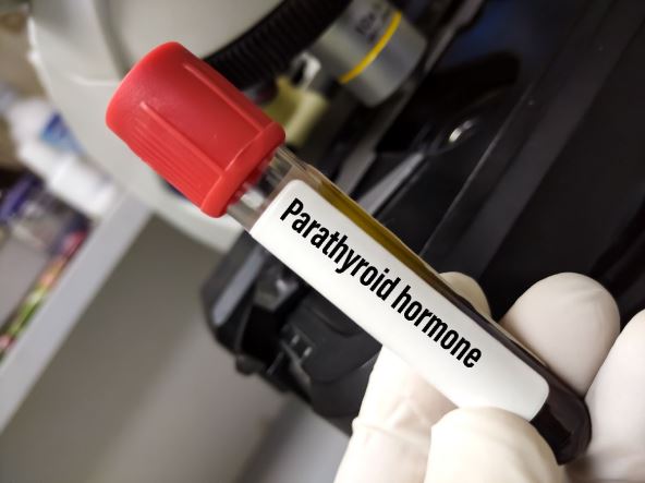 paratiroidne zlezde hormon.jpg