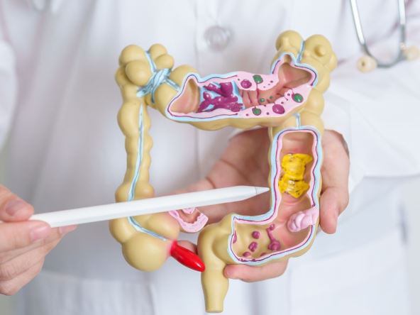 boli stomak iritabilni kolon.jpg