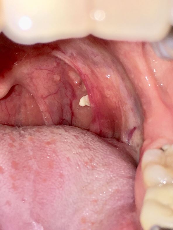 krajnici kamen 2.jpg