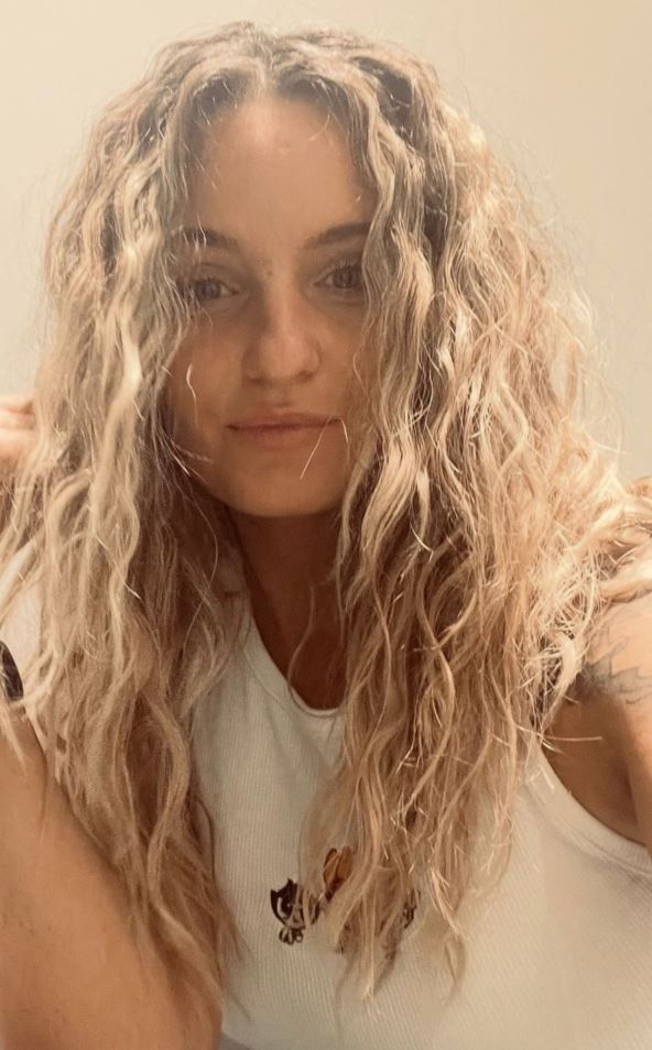 Ineta Petrajte o problemima sa kožom nakon korišćenja steroidnih krema