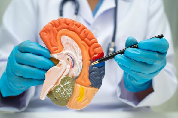 alchajmerova bolest demencija 3.jpg