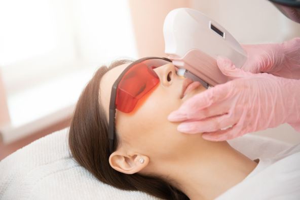 lasersko uklanjanje dlačica