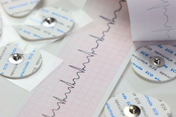 ekg_2441332213.jpg